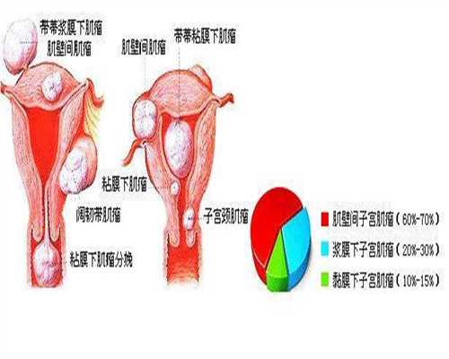 武汉代怀孕多少钱,这4类孕妈容易生出畸形儿，怨